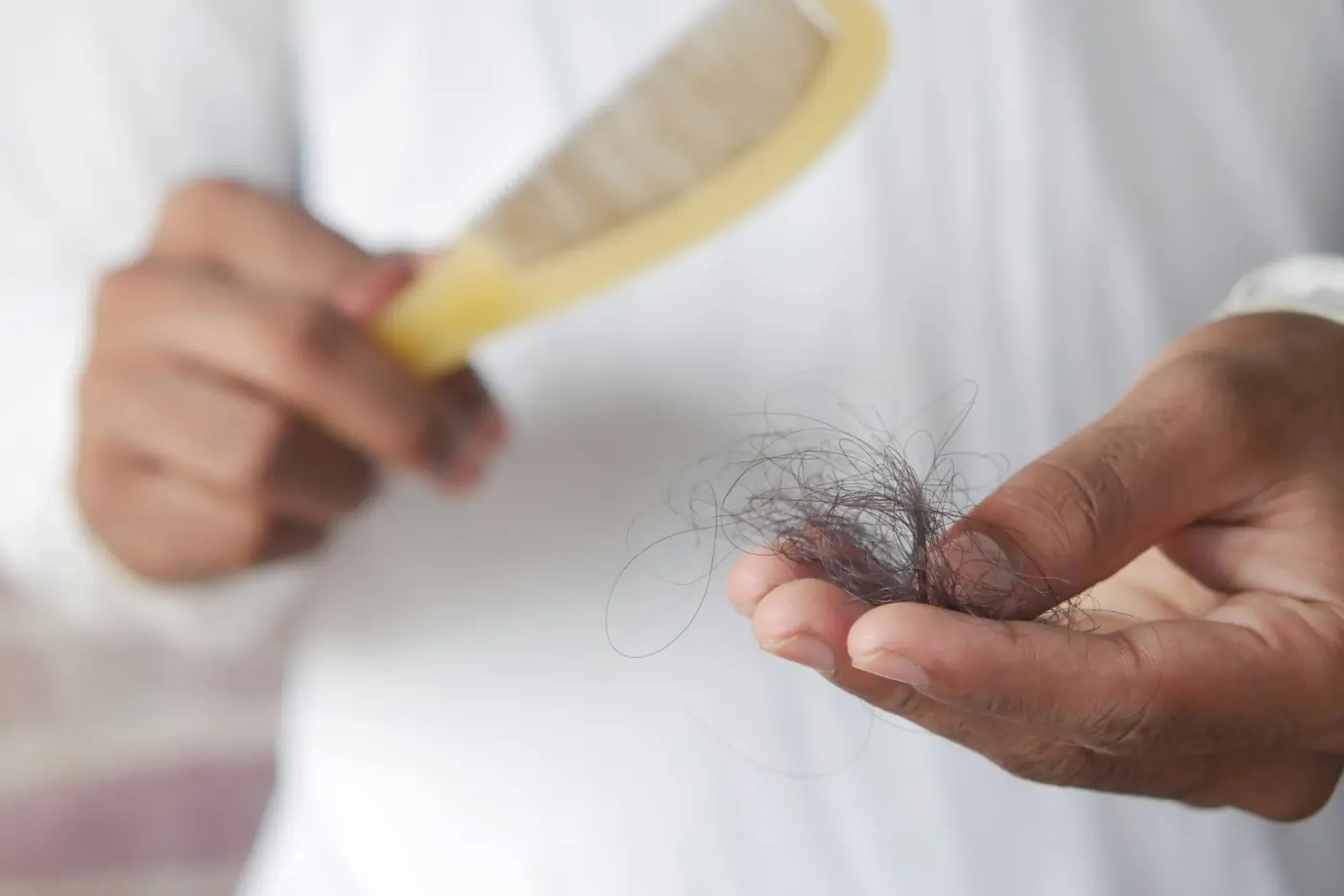 Scalp and hair image representing specialist hair loss diagnosis and treatment