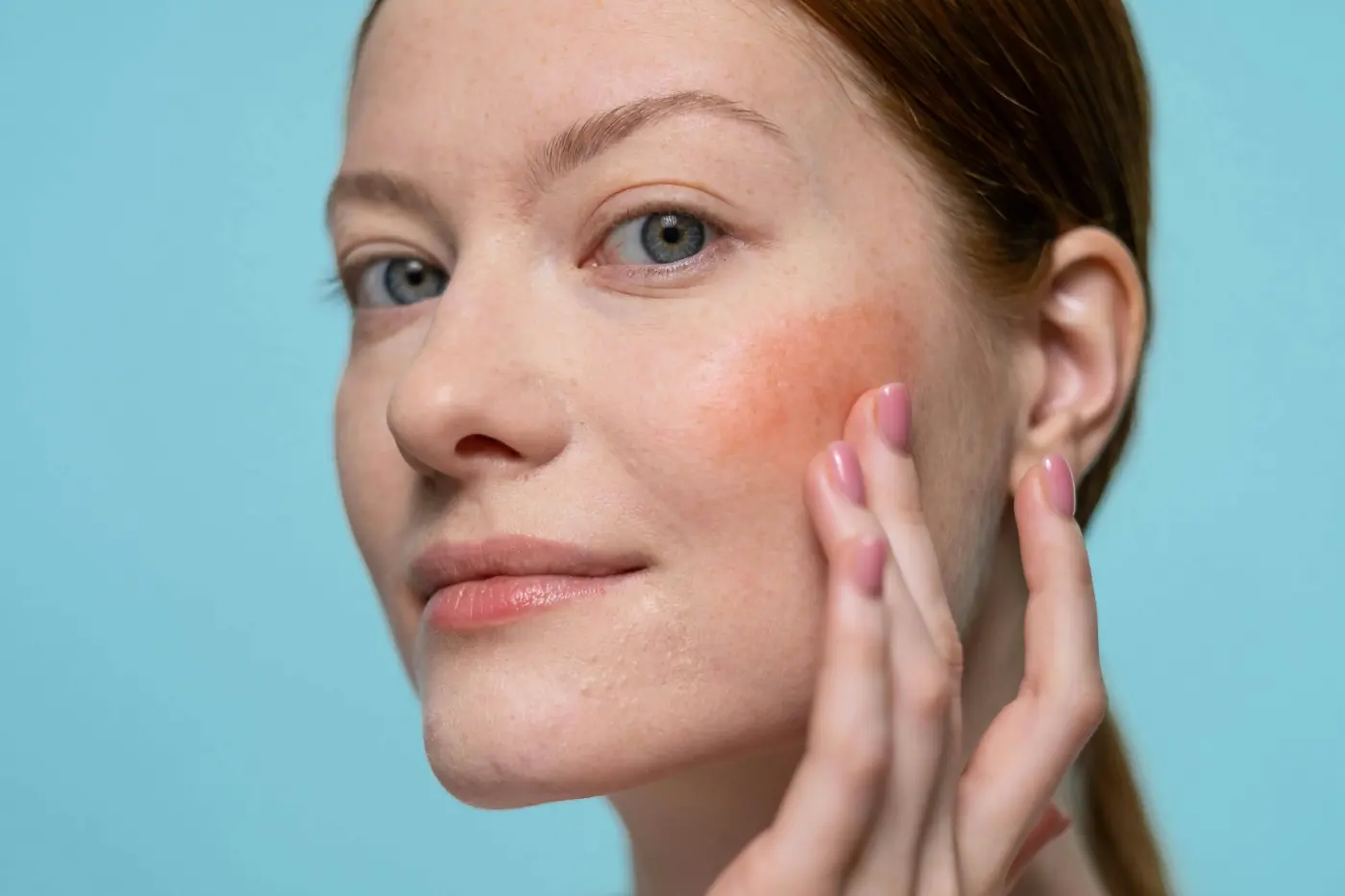 Facial skin image representing rosacea redness and flushing treatment